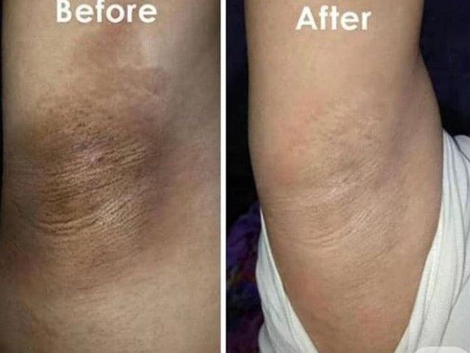 LipsnLayers Whitening Skin Polish